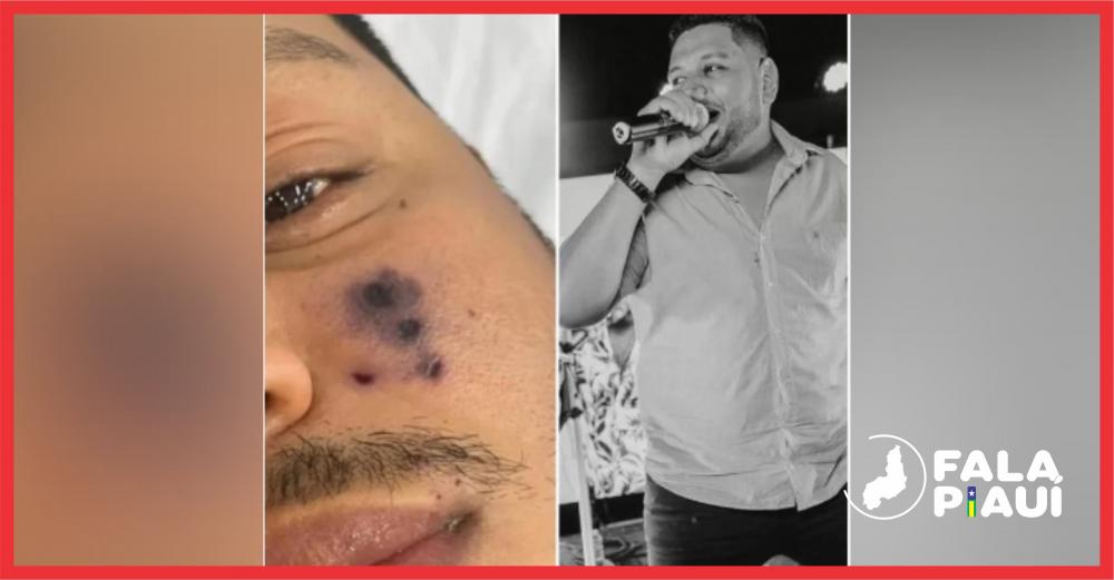 Cantor de forró morre após ser picado por aranha e rosto começar a escurecer